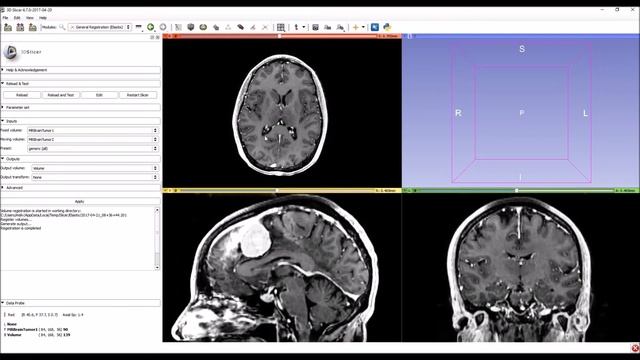 Elastix registration toolbox in 3D Slicer смотреть онлайн