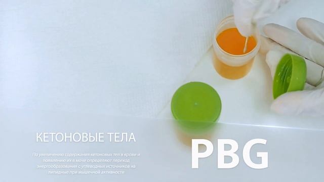 Холестерин и кетоновые тела смотреть онлайн