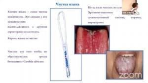Гигиена полости рта при заболеваниях пародонта, слизистой полости рта, твёрдых тканях зубов.