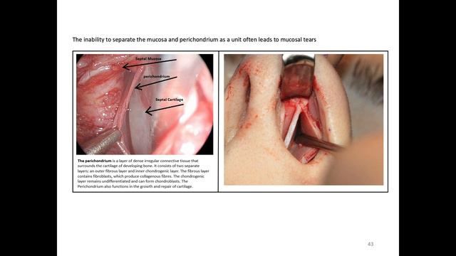Explore the Dark Truths of Nasal Surgery: Unveiling Hidden Damages and Unspoken Complications смотреть онлайн