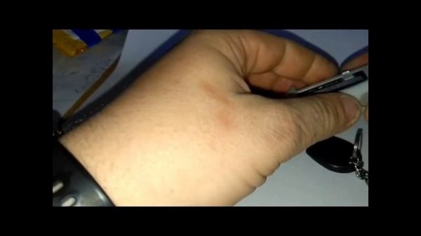 Scher-Khan Magicar 5. Нет Обратной связи