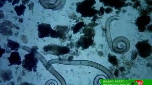 2019 08 20 Обнаружен трихинелёз у кабана