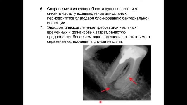 Эндодонтия 2. АФО пульпы зуба. Диагностика в эндодонтии смотреть онлайн
