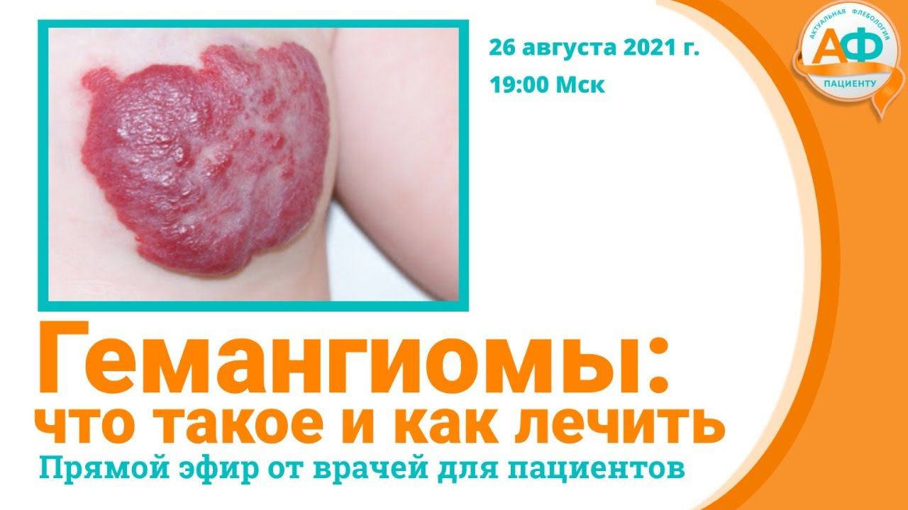 Гемангиомы: что это такое и как лечить? смотреть онлайн