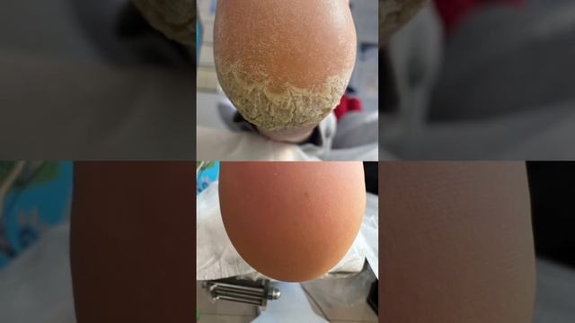 Педикюр и подология | MedNogi смотреть онлайн