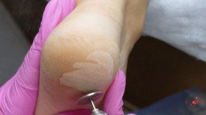 Педикюр смарт дисками без использования кератолитиков l простой и быстрый дизайн