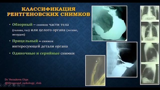 Рентгенологические методы.  Часть 2