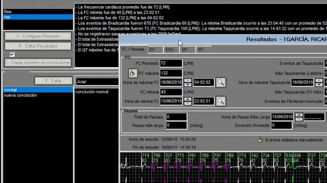 ECCOSUR - Módulo 10 - Tutorial Post procesamiento, Informe Final del estudio Holter HT 103 смотреть онлайн