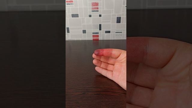 Как избавиться от укуса гуся. Последствия укуса смотреть онлайн