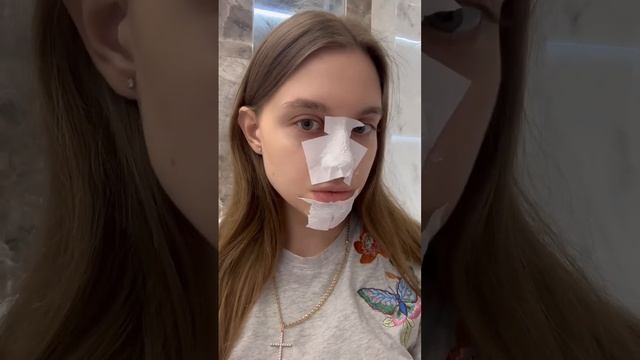 Маска от черных точек lanbena #shorts #черныеточки #lanbena #косметика #обзоркосметики #ринопластик смотреть онлайн