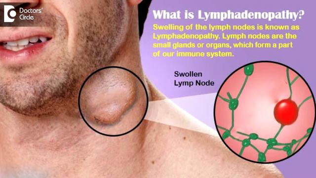 Diagnosis and management headaches, fatigue & enlarged lymph nodes - Dr. Surekha Tiwari смотреть онлайн