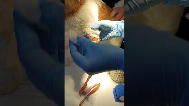 Как правильно снять внутривенный катетер смотреть онлайн