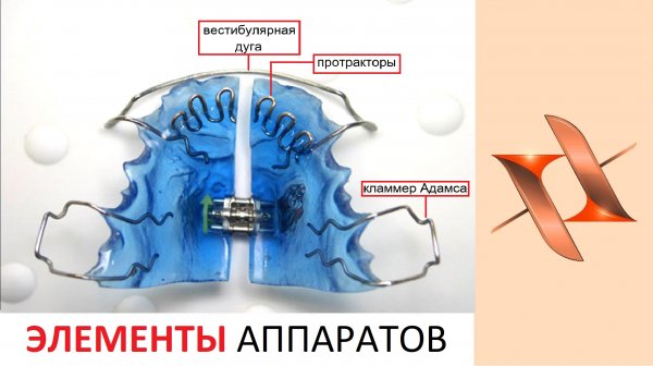 Элементы и устройство аппаратов. Ортодонтия.