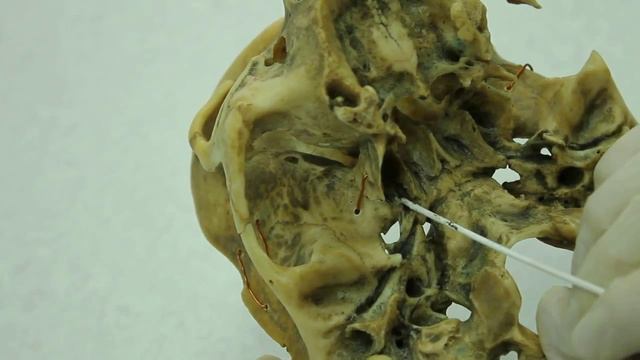 15. Крыловидно-небная ямка