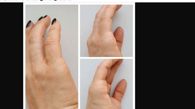 Венец безбрачия. когда выйду замуж? не везет в любви. Фото рук. Хиромантия смотреть онлайн