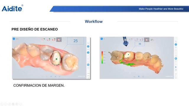 20210521 Cameo Intraoral Scanner Webinar-Octavio Saldaña смотреть онлайн