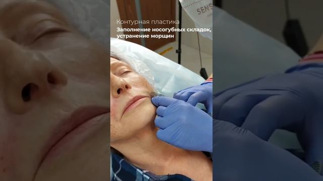 Контурная пластика лица смотреть онлайн