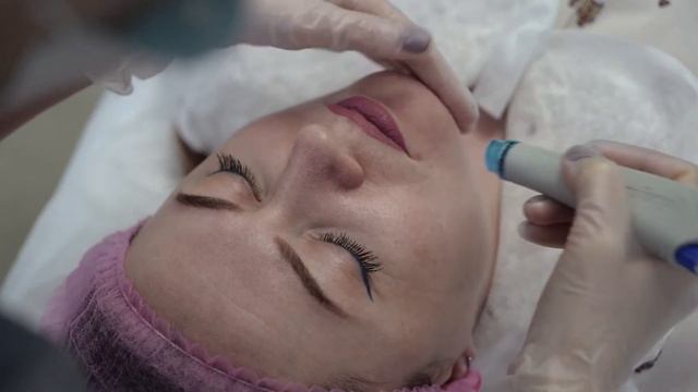 HydraFacial процедура голливудских звезд смотреть онлайн
