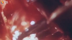 ОТЕЦ ОТРЕЗАЛ  НОГИ ДОЧЕРИ | ИСТОРИЯ ОТ КОТОРОЙ МУРАШКИ ПО ТЕЛУ