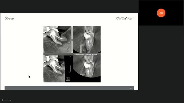 BACKSTAGE | Протокол трехмерного рентгенологического обследования смотреть онлайн