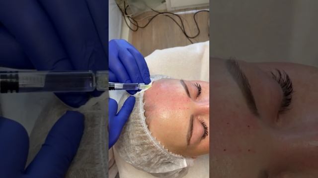 Atlantis Classic Процедура