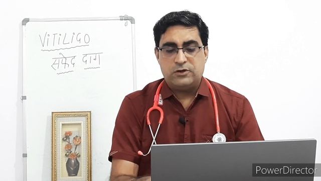 Vitiligo { Safed Daag } ka Best treatment | Tacrolimus ointment , Femcort cream , Pigmento ointment смотреть онлайн