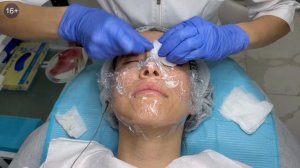 Как делается механическая чистка лица // Этапы классической чистки лица // №2