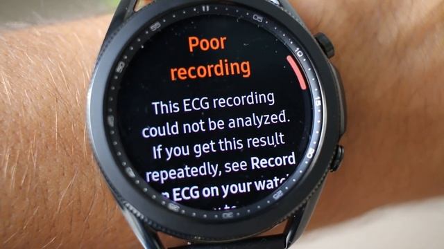 Como fazer um Eletrocardiograma num Relógio GPS смотреть онлайн