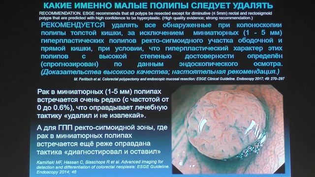 27 Федоров ЕД Три зубчатых новообразования в правых отделах кишки Тактика смотреть онлайн