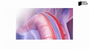 ПОЧЕМУ СТОИТ ПО УТРАМ (УТРЕННИЙ СТОЯК)