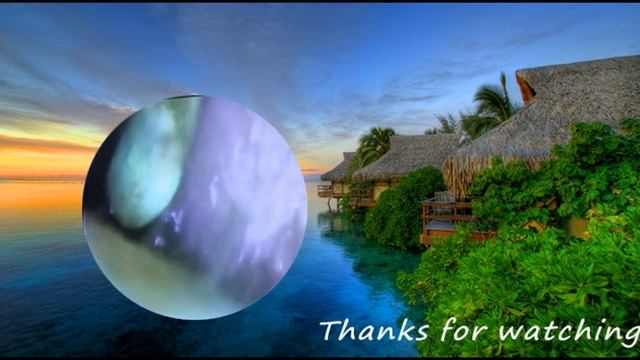 ear cleaning |чистка ушной серы смотреть онлайн