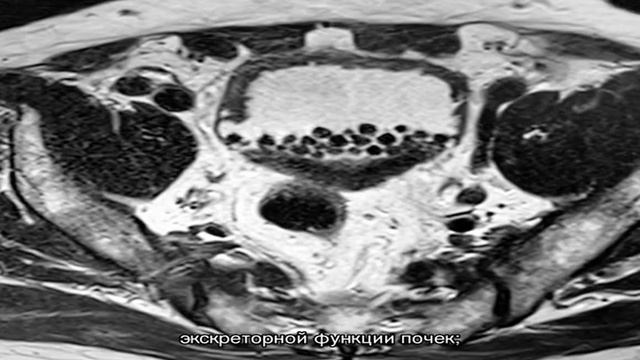 МРТ мочевого пузыря - цены в Москве смотреть онлайн