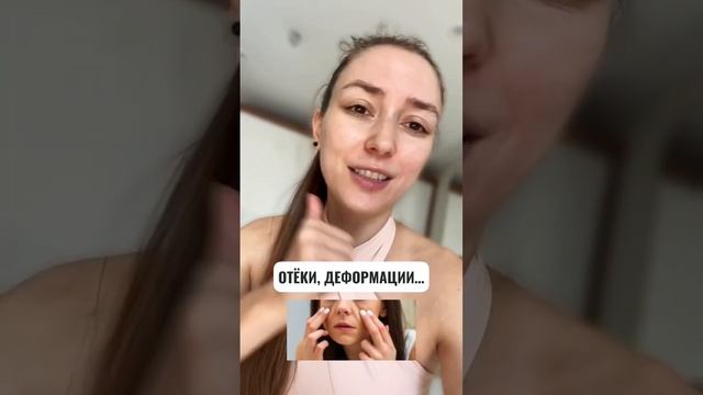 Почему НЕ НУЖНО вкалывать ФИЛЛЕРЫ?! смотреть онлайн