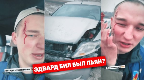 Эдвард Бил был пьян во время ДТП? | Новости | Эдвард Бил | Edward Bill