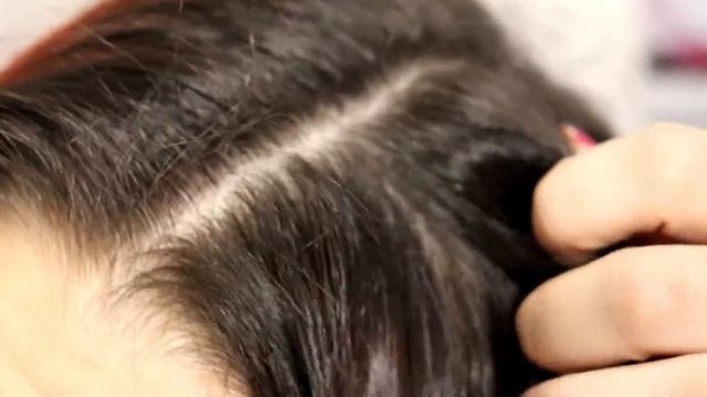 O SHAMPOO QUE RESOLVEU MINHA DERMATITE SEBORREICA | DOCTAR DARROW смотреть онлайн