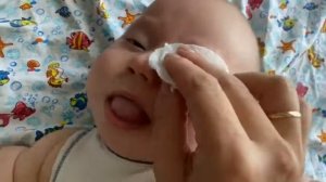 Массаж при дакриоцистите (закисании глазок ) новорождённого