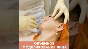 Объемное моделирование / Радиес в разведении