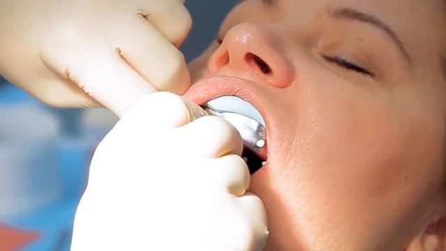 Операция имплантация зубов. ? Подробный пример операции имплантации зубов. Симпладент. 12+ смотреть онлайн