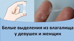 Белые выделения из влагалища у девушек и женщин.