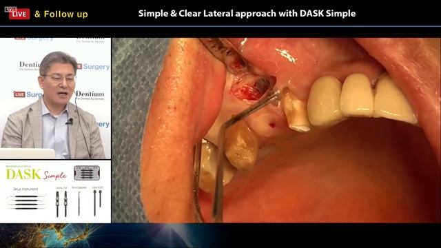 Live Surgery & Follow Up, 