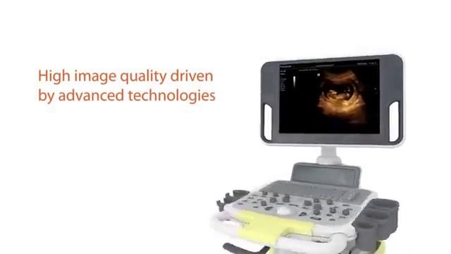 Mindray Ultrasound DC-N3 Video смотреть онлайн