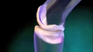 Что такое ревматизм