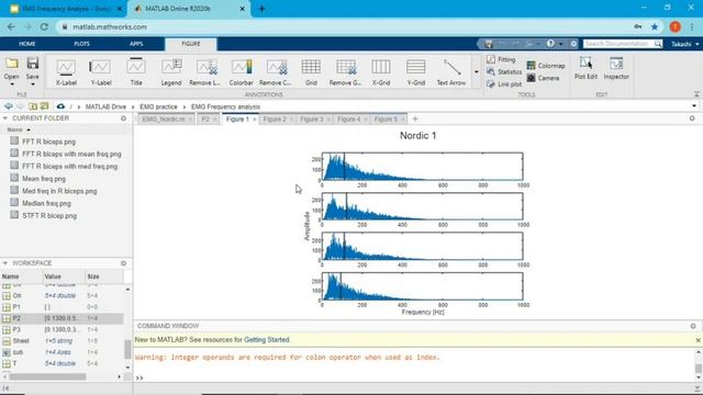 EMG Frequency Analysis -FFT, Mean / Median frequency, STFT- смотреть онлайн