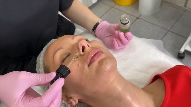 Уход tHermoCEuTICAL // М-КЛИНИК смотреть онлайн