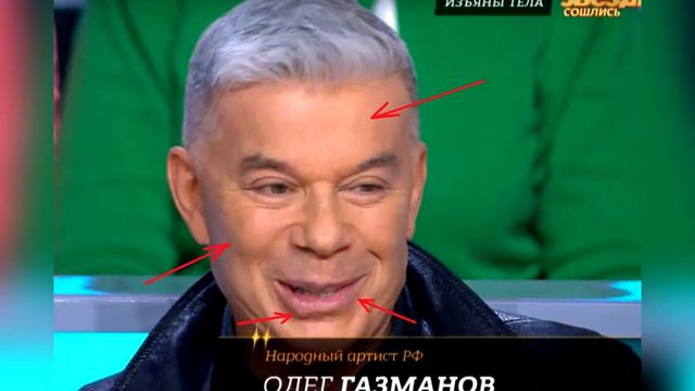 Олега Газманова подловили на пластике смотреть онлайн
