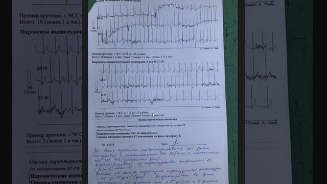 Запис 2018 11 04 11 33 56 428 смотреть онлайн