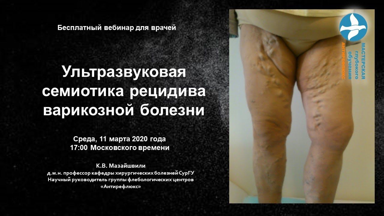 Ультразвуковая семиотика рецидива варикозной болезни смотреть онлайн