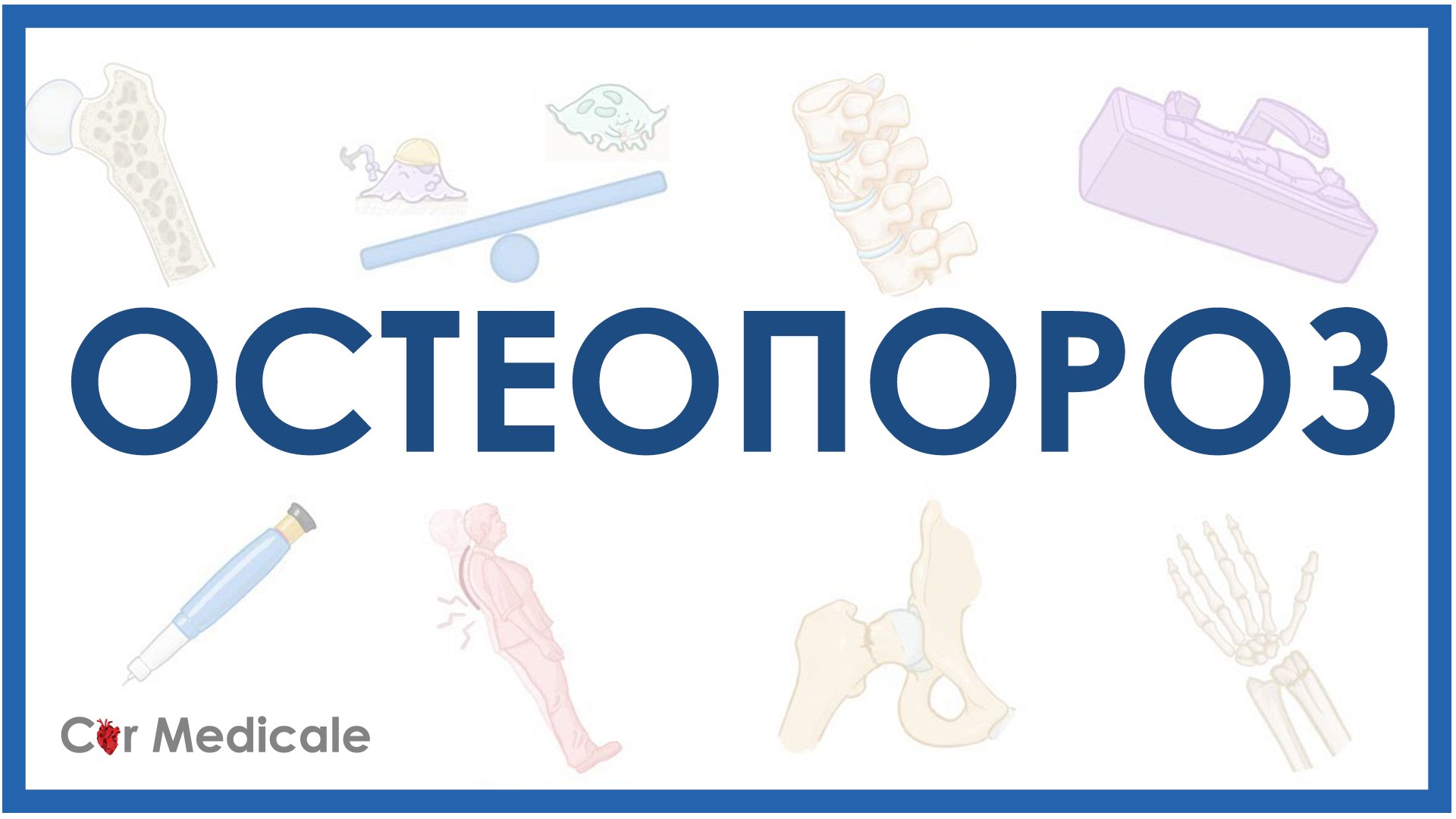 Остеопороз - причины, виды, проявления, диагностика смотреть онлайн