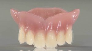 Виды зубных коронок