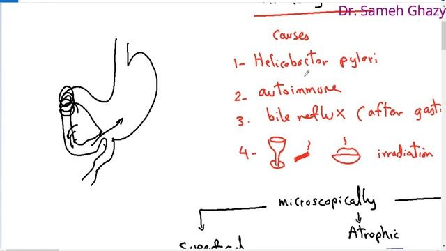 Systemic pathology 22 : GIT 3 ( gastritis ) DR.SAMEH GHAZY смотреть онлайн